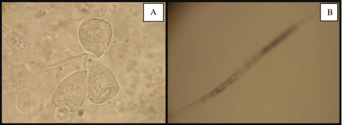 Figura 3  –  Micro-organismos removidos através de raspagem do muco do beijupirá, Rachycentron canadum, por  ocasião da coleta dos espécimes após experimento conduzido pelo LANOA