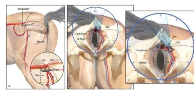 Figura 08: Painel a - Posicionamento do transdutor ultrassonografico com Doppler. O transdutor está  colocado contra a face lateral da aorta caudal e retraída gradualmente à origem da artéria ilíaca externa  (EI)