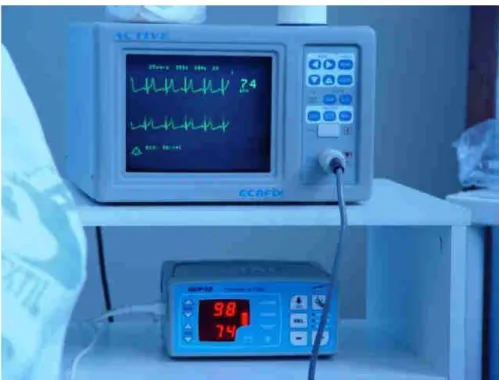 Figura 8 – Cardioscópio 5 vias ECAFIX, modelo active e oxímetro OXP-10 marca EMAI utilizados na  monitorização do traçado eletrocardiográfico , freqüência cardíaca e saturação de oxigênio