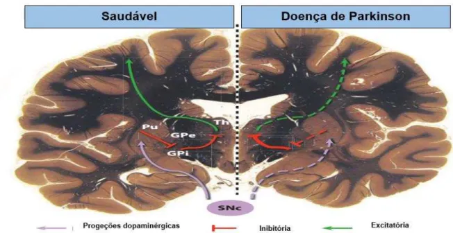 Figura 1: Diagrama simplificado dos circuitos neuronais lesionados durante DP.  