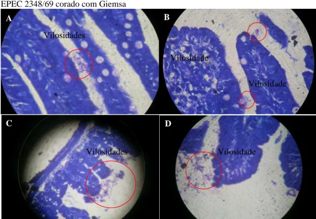 Figura  5  -  Microfotografia  de  íleo  de  camundongo  Swiss  infectado  com  10 8 ufc/mL  de  EPEC 2348/69 corado com Giemsa