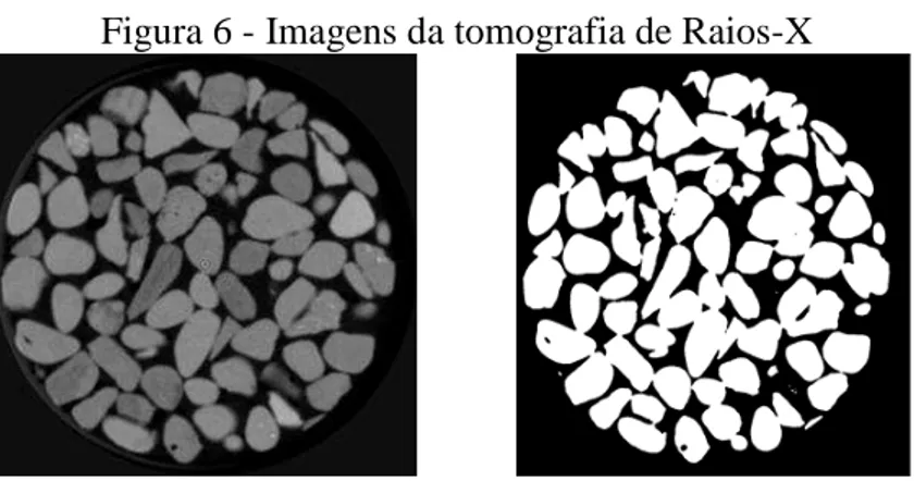 Figura 6 - Imagens da tomografia de Raios-X 