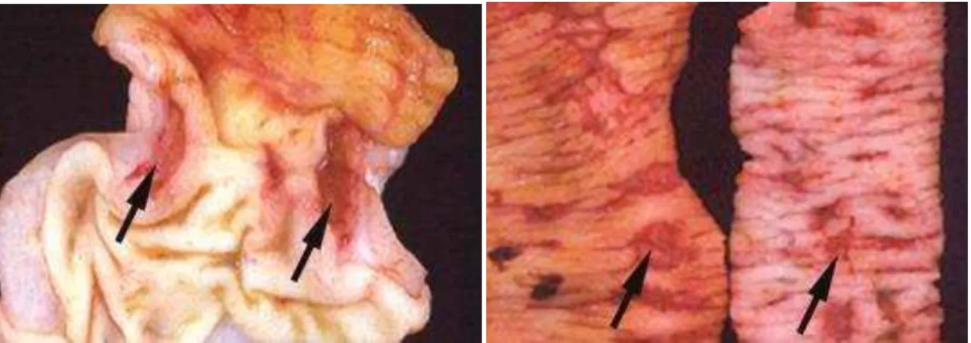 Figura  5 – Ulcerações  hemorrágicas  na  porção  gastroduodenal  em  estômago  de  cães,  induzidas pela indometacina