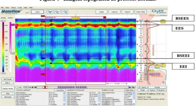 Figura 4 - Imagem topográfica de pressões normais 