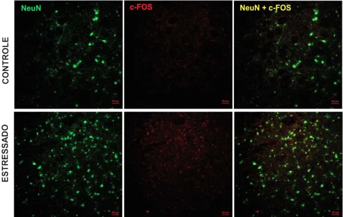Figura 18  –  Fotomicrografia da imunoexpressão de c-Fos no trato espinhal trigeminal de ratos  submetidos ao estresse emocional 