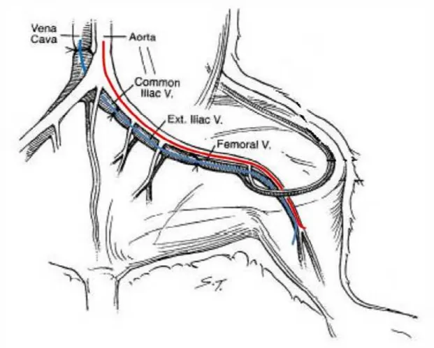Figura 7. Localização anatômica da artéria e veia femoral e posicionamento dos cateteres arterial  (vermelho) e venoso (azul)
