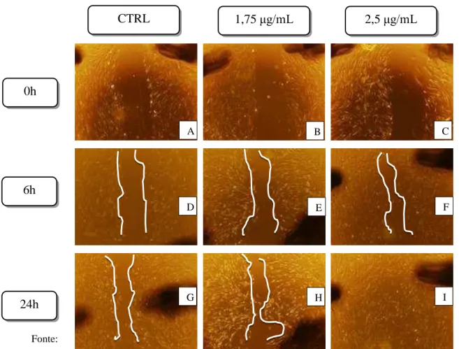 Figura  5  -  Fotomicrografias  do  efeito  do  triterpeno  (CLF-1)  de  Combretum  leprosum   no  ensaio de migração de fibroblastos  in vitro