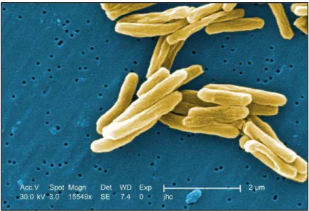 Figura 4 - Micrografia eletrônica do Mycobacterium tuberculosis. 