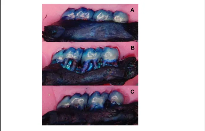 Figura 8: Aspecto macroscópico do periodonto de ratos normais (A) ou submetidos à  periodontite tratados com Salina (B) ou com Ranelato de estrôncio (C): Os animais  foram submetidos à periodontite por corpo estranho e receberam RS (630 mg/kg-vo) ou  Salin