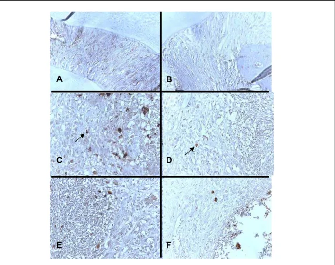 Figura 10: Fotomicrografias do periodonto de ratos para a detecção de TNF- α  e IL-1 β :  Os ratos foram submetidos a periodontite através da colocação do fio de náilon em torno  dos segundo molares superiores esquerdos e receberam RS (630 mg/kg-vo) ou Sal