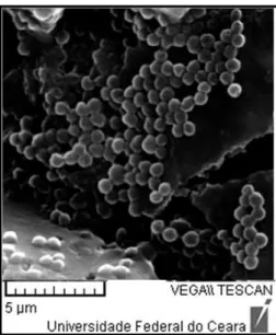 FIGURA 7. Morfologia de bactérias do gênero Staphylococcus spp. caracterizada por células esféricas agrupadas  de forma irregular, remetendo a cachos de uvas