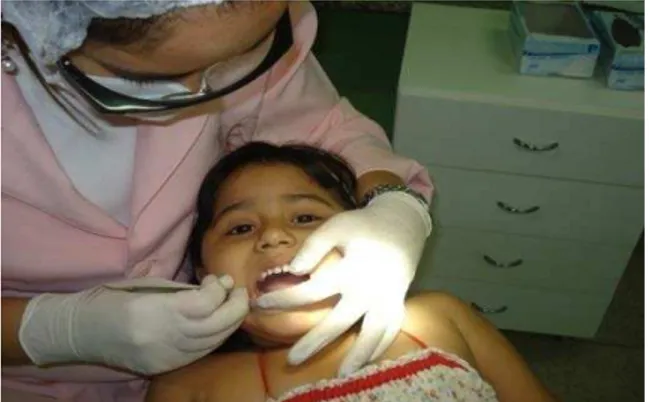 Figura 4- Exame clínico realizado no consultório odontológico do CSF Prof. José Valdevino de Carvalho 