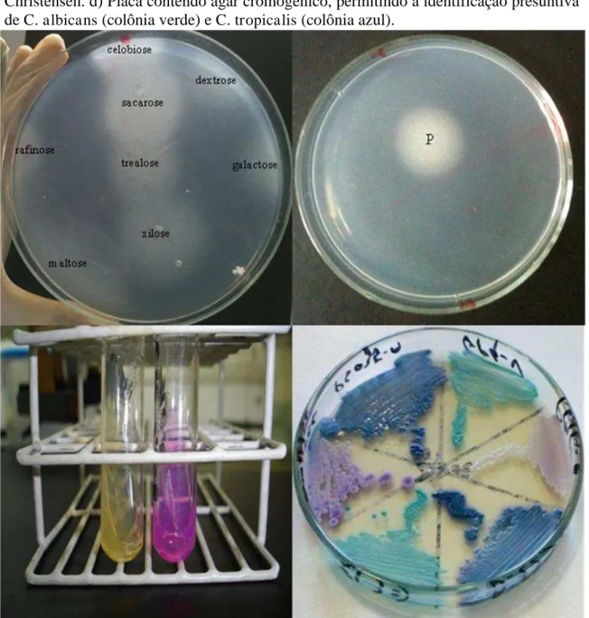 Figura  4  –   a)  Prova  de  assimilação  de  carboidrato  de  Candida   spp.  Observa-se  crescimento  fúngico  avaliada  assimilou  os  açúcares