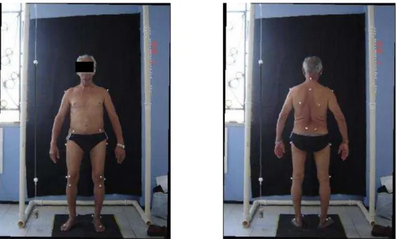Figura 7. Fotografias realizadas na vista anterior e posterior para análise postural. 