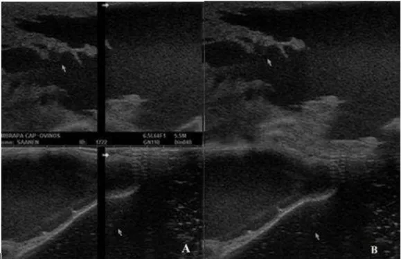 Figura 9. Tomada das imagens duplas nos extremos das estruturas da glândula mamária  e dos tetos (A);edição das imagens duplas, eliminando a área de interseção e montando  a imagem única (B)