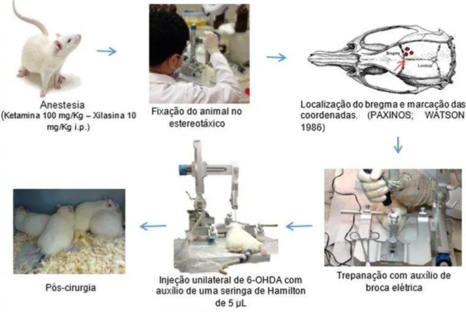 Figura 09 - Ilustração do Modelo de Doença de Parkinson induzido por injeção unilateral de 6- 6-hidroxidopamina (6-OHDA)