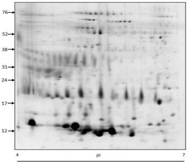 Figura  1.  Eletroforese  2-D  das  proteínas  do  plasma  seminal  de  carneiros  da  raça  Morada Nova submetidos a níveis crescentes de suplementação com ração concentrada  na dieta