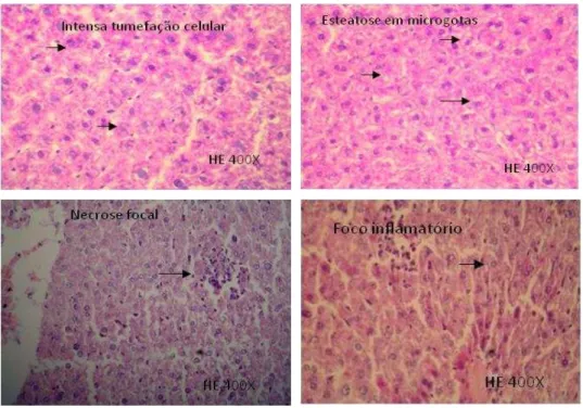 Figura 6 - Alterações histopatológica observadas no fígado dos animais tratados com  extratos  da  comunidade  fitoplanctônica  da  água  de  viveiros  de  camarão:A –   tumefação  dos  hepatócitos;  B  –   Esteatose  em  microgotas;  C  -  Necrose  focal 