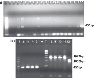 Fig. 2. Gel electrophoresis of PCR products using flanking primers D1 and D2 for detection of plaques containing phage D29 with a deletion in the right arm