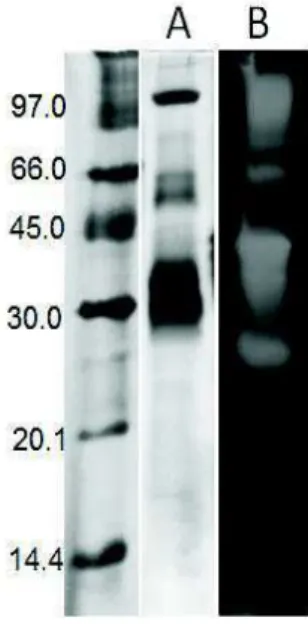Figura 9 - (A) 1D-SDS-PAGE (12,5%) e (B) zimograma para detecção de peptidases  na fração TpLP 