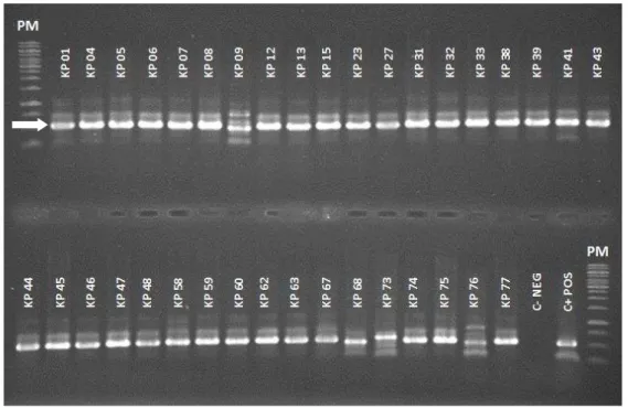 Figura 2  –  Gel de agarose a 1% contendo fragmentos dos genes  bla CTX-M-1/2  amplificados por  PCR  das  amostras  de  K