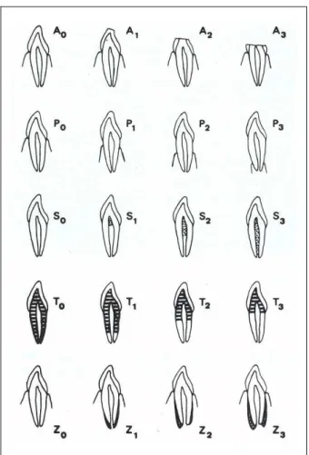 Figura 5 - Estágios da classificação de Gustafson (SILVA, 2002). 