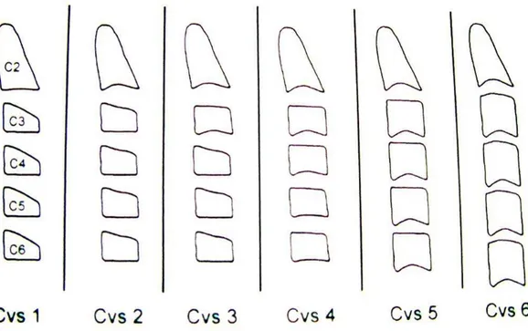 Figura 8 - Indicadores de Maturação das Vértebras Cervicais (IMVCs) (AM JR. ORTHOD &amp; DENT,  2003)
