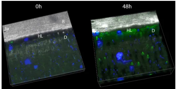 Figure  3:  Tri-dimensional  models  of  the  acquired  images  at  baseline  (Fig.  3a)  and  after  incubation  with  gelatin  showing  extensive  fluorescence  within  the  hybrid  layer  Fig