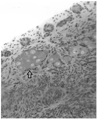 Figura  02.  Folícul ovariana de cadela No  parênquima  ov estágios  de  desenvolvimen frequentemente  ocupavam  antrais (FIGURA 03)