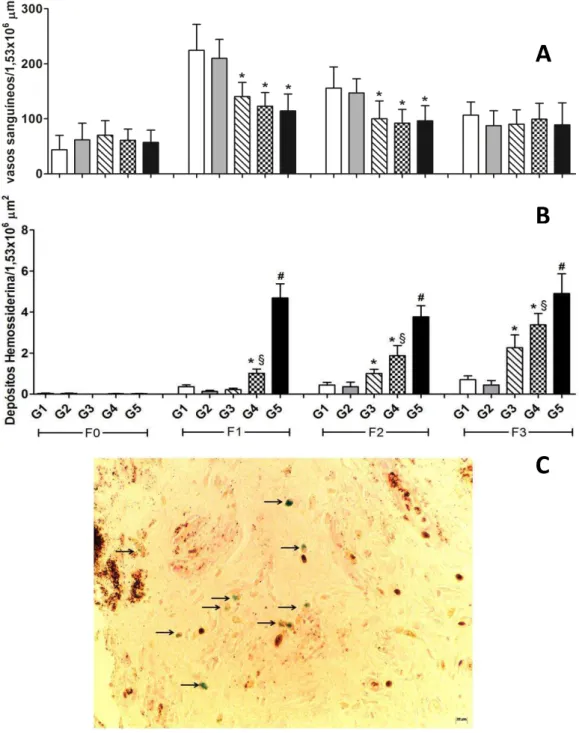 Figura  4:  Efeito  do  álcool  e  da  dieta  hipercalórica  na  quantidade  total  de  vasos  (A)  e  depósitos  de  hemosiderina  (G4)  (B)  em  feridas  cutâneas  de  ratos  wistar