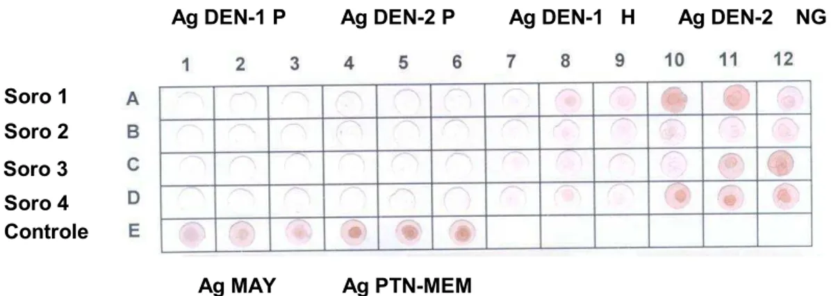 FIGURA 5   Resultados dos testes de immuno-dot blot, comparando a reação  dos  vírus  DEN-1  e  DEN-2  purificados  (P)  com  as  amostras  de  vírus  DEN-1  (Havaí=H)  e  DEN-2  (Nova  Guiné=NG),  amostras  sementes