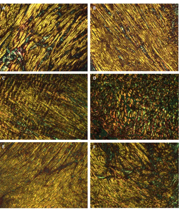 Figura 4      -   Fotomicrografia das fibras colágenas observadas em microscópio de luz polarizada