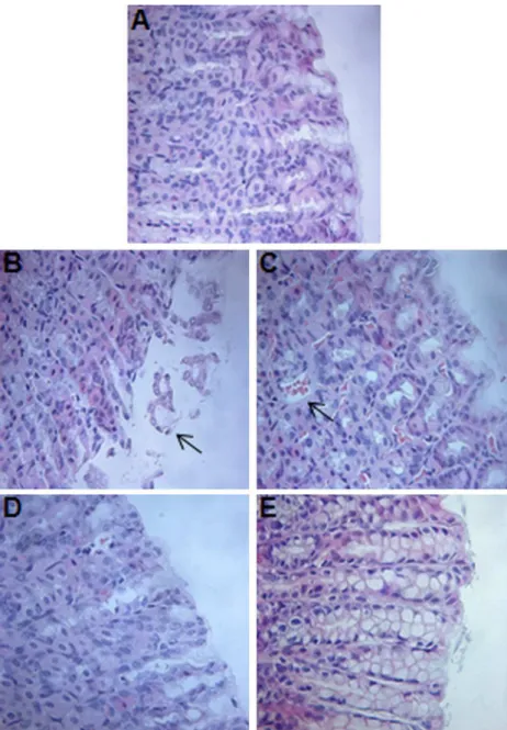 Fig. 2. Histopathological changes in the gastric mucosa (40 magnification). (A) Control (saline) group showing gastric mucosal integrity