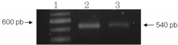 Figura 1. Amplificação dos genes prM/DENV-2 e prM/DENV-3. Eletroforese dos 