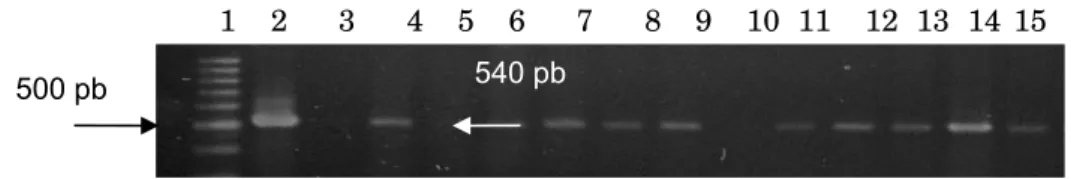 Figura 2. Clonagem de prM/DENV-2 em vetor pGEM-T. Eletroforese em gel de 