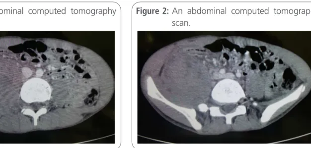 Figure 1:   An abdominal computed tomography  scan.