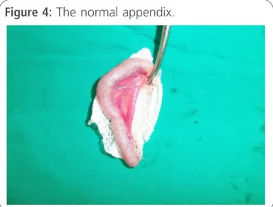 Figure 4: The normal appendix.