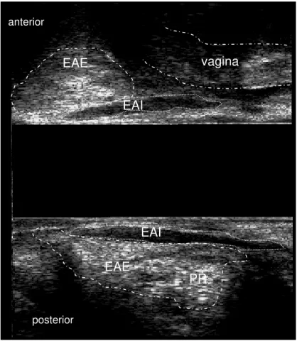Figura 6 – Anatomia ultrassonográfica do canal anal. Paciente do sexo feminino.   
