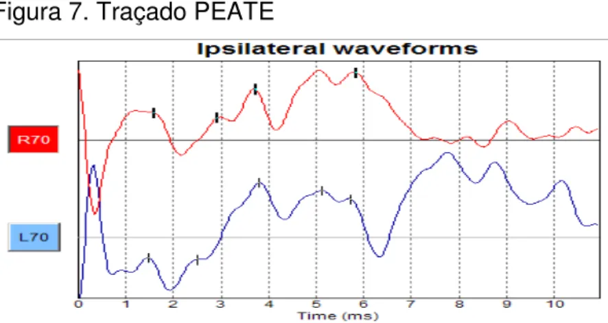 Figura 7. Traçado PEATE 