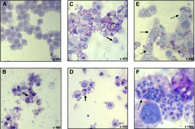 Fig. 3. Effect of (4-methoxyphenyl)(3,4,5-trimethoxyphenyl)methanone (PHT) on cell morphology of HL-60 human leukemia cells