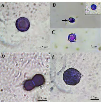 Fig.  1. Morfologia  de  diferentes  hemócitos de  Polybia  platycephala  (Hymenoptera:Vespidae)