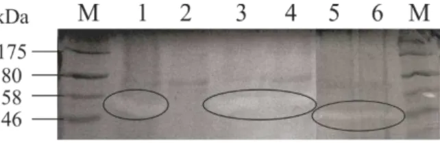 Figure 1  – Detection of proteases by casein zymography under non-reducing conditions