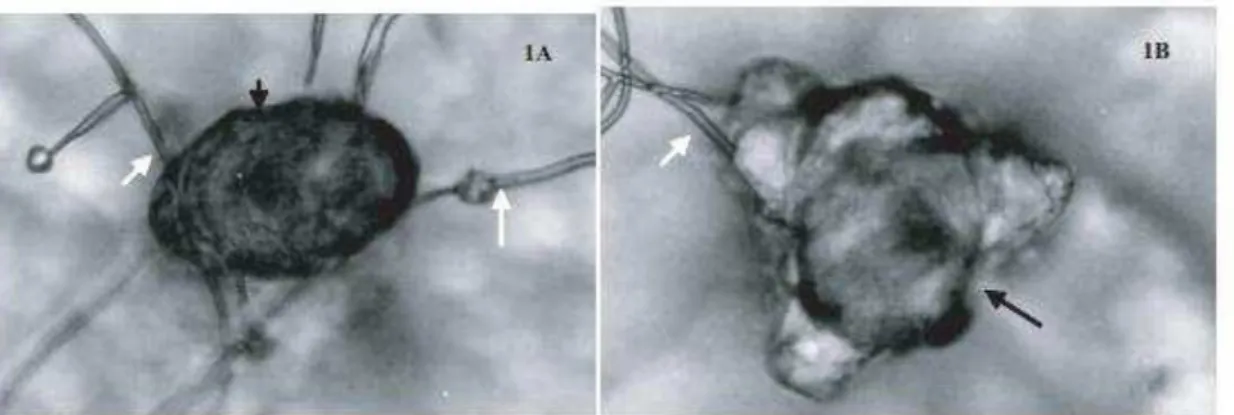 Figura  2:   A  – Hifas de Pochonia chlamydosporia (seta branca) colonizando o ovo  de  Enterobius  vermicularis  (seta  preta);  B  –  Destruição  do  ovo  do  nematoide  pelo  fungo  aos  10  dias  de  interação  (Microscopia  óptica  com  aumento  de  4