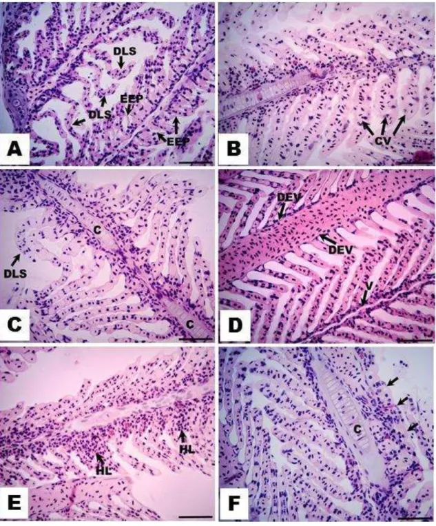 Figura  5.  Alterações  histopatológicas  mais  frequentes  nas  brânquias  de  machos  e  fêmeas  de  H