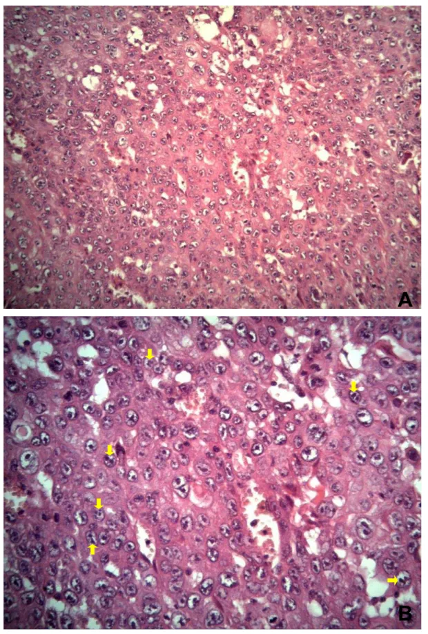 Figura  2.  Carcinoma  de  células  escamosas  cutâneo  pouco  diferenciado  em  um  cão