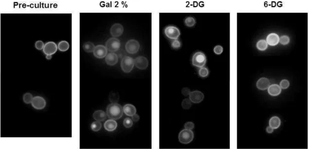 Figure 5   The effect of the glucose analogues 2-DG and 6-DG on Lac12-GFP 523 