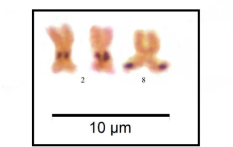 FIG.  8.  Variação  na  técnica  de  Ag-NOR  detectada  em  um  indivíduo  de  Prochilodus  costatus localizado a montante da UHE Três Marias