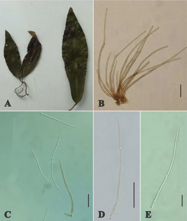 Fig. 2: Cercospora apii on Dolichandra unguis-cati.A. Symptons of leaf spots B. 