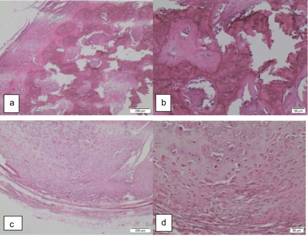 Figura  4   Lesões  não  neoplásicas  de  mama  em  cadelas  submetidas  à  mastectomia,  no  período  de  1º  de  junho  a  30  de  setembro  de  2014:  (a)  mastite  (aumento  40x);  (b)  mastite  (aumento  100x);  (c)  mastite  (aumento  400x);  (d)  hi