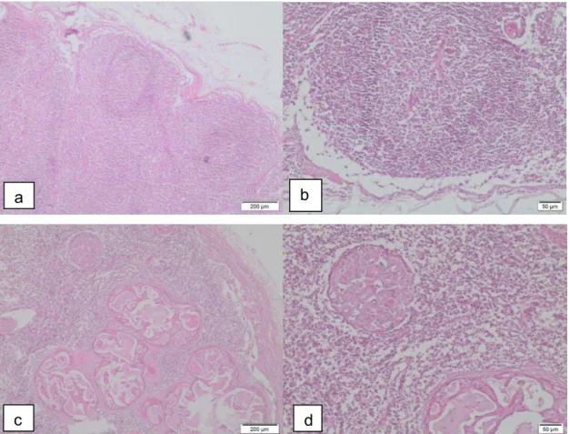 Figura 10   Linfonodo inguinal sentinela em cadela submetida  à mastectomia:  (a)  linfonodo  inguinal  sem  neoplasia  (aumento  40x);  (b)  linfonodo  inguinal  sem  neoplasia  (aumento  100x);  (c)  linfonodo  inguinal  contendo  metástase  (aumento  40